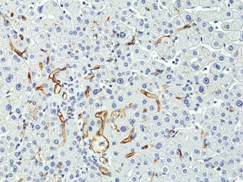 CD34 Antibody Liver IHC. Immunohistochemistry testing of formalin fixed and paraffin embedded human liver tissue with recombinant CD34 antibody at 1:400 dilution. HIER: steam section in pH6 citrate buffer for 20 min and allow to cool prior to staining.
