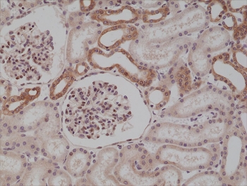 IHC testing of formalin fixed and paraffin embedded human kidney tissue with recombinant MyD88 antibody at 1:250 dilution. HIER: steam section in pH6 citrate buffer for 20 min and allow to cool prior to staining.