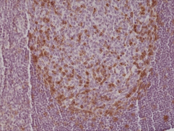 IHC testing of formalin fixed and paraffin embedded human tonsil tissue with recombinant PD-1 antibody at 1:500 dilution. HIER: steam section in pH6 citrate buffer for 20 min and allow to cool prior to staining.