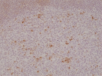 IHC testing of formalin fixed and paraffin embedded human tonsil tissue with recombinant OX40 antibody at 1:500 dilution. HIER: steam section in pH6 citrate buffer for 20 min and allow to cool prior to staining.