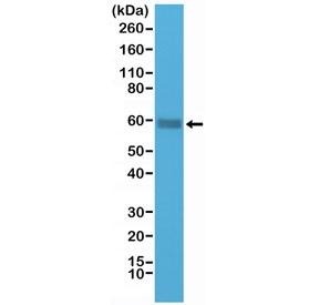 CD5 Antibody for WB. Western blot analysis of CD5 antibody in human Jurkat cell lysate using a C-terminal directed antibody. A band is detected at approximately 55-67 kDa, consistent with the predicted molecular weight of CD5, with size variation reflecting known glycosylation of this membrane glycoprotein. Detection using a C-terminal epitope confirms recognition of the intracellular domain, supporting analysis of CD5 independent of extracellular epitope accessibility.