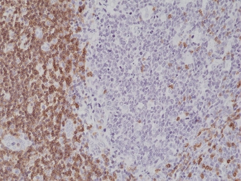 CD5 Antibody for IHC. Immunohistochemistry analysis of CD5 antibody staining in FFPE human tonsil tissue using a C-terminal directed antibody. Strong membranous staining is observed in interfollicular T lymphocytes with dense labeling of T cell zones surrounding germinal centers, while follicular B cell regions remain largely negative. Detection using a C-terminal epitope supports recognition of CD5 independent of extracellular domain accessibility and reflects its intracellular signaling-associated region. Heat-induced epitope retrieval was performed in pH 6 citrate buffer for 20 minutes followed by cooling prior to antibody incubation.