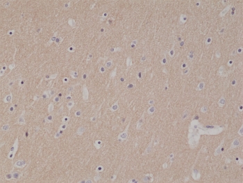 IHC testing of formalin fixed and paraffin embedded human brain tissue with recombinant CD56 antibody at 1:1000 dilution. HIER: steam section in pH6 citrate buffer for 20 min and allow to cool prior to staining.