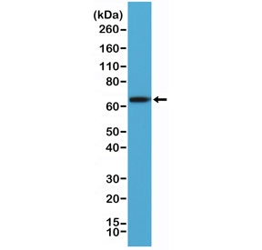 PLAP Antibody A431 WB. Western blot analysis of human A431 cell lysate using PLAP Antibody detects a strong band at approximately 65-70 kDa, consistent with placental alkaline phosphatase / ALPP. Although the predicted molecular weight of PLAP is approximately 58 kDa, the protein is routinely visualized at higher apparent molecular weights due to extensive glycosylation and post-translational processing characteristic of this membrane-associated alkaline phosphatase family member. This N-terminal epitope antibody supports detection of processed ALPP species in epithelial-derived cellular populations.