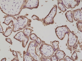 PLAP Antibody Placenta IHC. Immunohistochemistry analysis of formalin-fixed, paraffin-embedded human placenta tissue stained with PLAP Antibody demonstrates strong circumferential membranous HRP-DAB brown staining outlining trophoblast-lined chorionic villi and syncytiotrophoblast-associated epithelial surfaces. The staining pattern is consistent with expression of placental alkaline phosphatase / ALPP within placental trophoblastic compartments and highlights membrane-associated localization of this N-terminal epitope antibody. Antibody dilution: 1:500. HIER: steam section in pH6 citrate buffer for 20 min and allow to cool prior to staining.