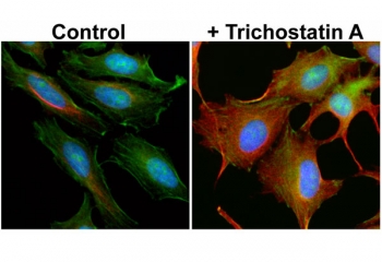 IF/ICC testing of human HeLa cells, untreated (-) or treated (+) with Trichostatin A, with recombinant Acetylated Alpha Tubulin antibody (Red) at 1:5000. Green = actin fillaments, Blue = DAPI nuclear counterstain.