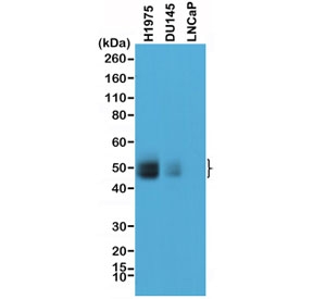 PD-L1 Antibody Western Blot. Western blot analysis of PD-L1 (CD274) expression in human prostate cancer cell line lysates including DU145 and LNCaP using recombinant rabbit monoclonal clone RM320. A band is detected at approximately 45-55 kDa, consistent with glycosylated PD-L1, with possible weaker signal near the predicted molecular weight of ~34 kDa representing the unglycosylated form. PD-L1 is a known glycoprotein, and the observed band pattern reflects post-translational glycosylation and relatively low baseline expression in these prostate cancer cell lines.