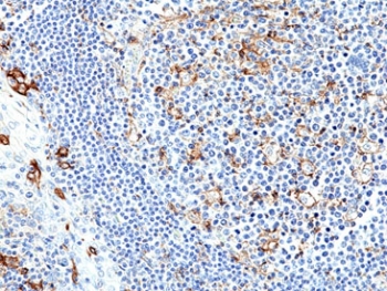 PD-L1 Antibody Tonsil IHC. Immunohistochemistry analysis of PD-L1 (CD274) expression in FFPE human tonsil using recombinant rabbit monoclonal clone RM320 at 1:250. The antibody demonstrates membranous HRP-DAB brown staining in scattered immune cells within interfollicular regions, consistent with localized immune checkpoint activity. The staining pattern highlights heterogeneous PD-L1 expression across immune cell populations within the lymphoid microenvironment.