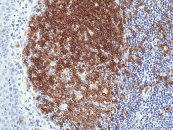 IHC staining of FFPE human tonsil tissue with recombinant CD19 antibody at 1:1000.