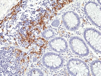 IHC staining of FFPE human colon tissue with recombinant CD19 antibody at 1:1000.