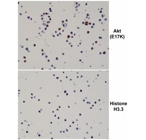 AKT E17K Mutant Antibody Cell Pellet IHC. Immunohistochemistry of FFPE human 293T cell pellets transfected with an AKT E17K expression construct shows distinct HRP-DAB brown cytoplasmic and nuclear staining in E17K-expressing cells, while control cells expressing Histone H3.3 show minimal background, supporting mutation-specific detection of the AKT E17K variant; clone RM336 was used for staining.