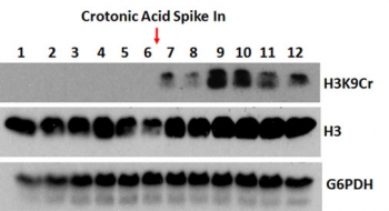H3K9cr Antibody / HIST1H3A Crotonylation Chromatin Activation Antibody (clone RM339) for WB. Western blot analysis of HIST1H3A / Histone H3 Lys9 crotonylation (H3K9cr) in cells treated with a crotonylation-inducing metabolite using H3K9cr Antibody / HIST1H3A Crotonylation Chromatin Activation Antibody. Increased H3K9cr signal is observed following metabolite treatment, consistent with metabolically driven chromatin activation. Total Histone H3 and G6PDH are included as controls, confirming equal loading and supporting selective detection of the crotonylated H3K9 state.