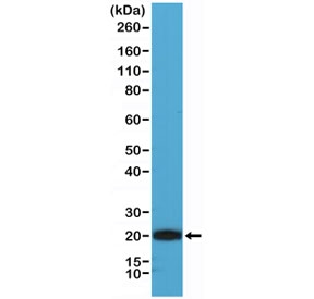 CD3 epsilon Antibody western blot. Analysis of CD3 Epsilon / CD3E antibody using CD3 epsilon Antibody / T Cell Receptor Signaling Marker Antibody in human Jurkat cell lysate. Lane 1: human Jurkat cell lysate. A band is detected at approximately 23 kDa, consistent with the predicted molecular weight of CD3 epsilon. The strong, well-defined band supports reliable detection of CD3E and aligns with its role as a key component of T cell receptor signaling pathways.