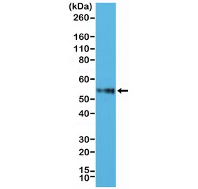 CD4 Antibody for WB. Western blot analysis of CD4 antibody in human Jurkat cell lysate. Lane 1: Jurkat cell lysate. A band is detected at approximately 50-55 kDa, consistent with the predicted molecular weight of CD4, with migration reflecting the glycosylated form of this membrane-associated receptor.