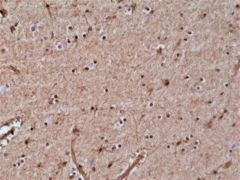 IHC staining of FFPE human brain tissue with recombinant GST pi antibody at 1:20,000.
