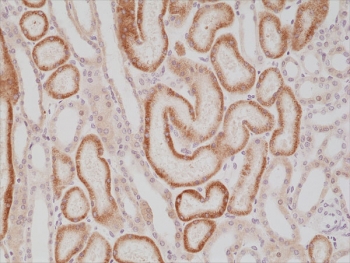 AMACR Antibody Kidney Immunohistochemistry. IHC staining of FFPE human kidney tissue with recombinant AMACR antibody at 1:1000.