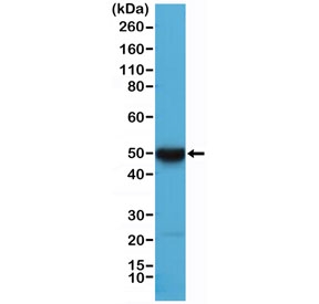 Cytokeratin 17 Antibody for WB (clone RM351) western blot analysis of human HeLa cell lysate. Western blot detection using the recombinant rabbit monoclonal Cytokeratin 17 Antibody for WB (clone RM351) reveals a clear immunoreactive band in human HeLa cell lysate. Lane 1: human HeLa cell lysate. A band is detected at approximately 48 kDa, consistent with the expected molecular weight of Cytokeratin 17 (CK17 / KRT17), an epithelial intermediate filament protein that forms part of the cytoskeletal keratin network in epithelial cells.