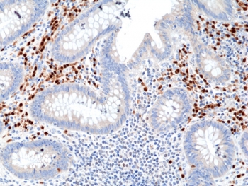 IHC staining of FFPE human appendix tissue with recombinant IRF4 antibody at 1:800.