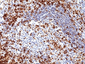 CD5 Antibody for IHC. Immunohistochemistry analysis of CD5 antibody staining in FFPE human tonsil tissue using an N-terminal directed antibody. Strong membranous staining is observed in interfollicular T lymphocytes with dense labeling of T cell zones surrounding germinal centers, while follicular B cell regions remain largely negative. Detection using an N-terminal epitope reflects recognition of the extracellular domain of CD5, supporting analysis of cell surface expression and lymphocyte identification within tissue.
