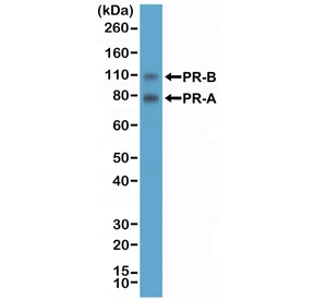 PR Antibody for WB analysis of Progesterone receptor / PGR by western blot. Human T-47D cell lysate was analyzed using PR Antibody for WB (clone RM357) at 1:2000 dilution. A band is detected at approximately 82-94 kDa corresponding to the predicted molecular weight of the PR-A isoform and a second band at approximately 99-120 kDa corresponding to the larger PR-B isoform of Progesterone receptor (PGR). The two bands reflect the well-characterized alternative transcription start sites that generate the PR-A and PR-B receptor isoforms commonly detected in hormone-responsive breast cancer cell lines such as T-47D.