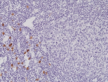IHC staining of FFPE human tonsil tissue with recombinant CD117 antibody at 1:2000.