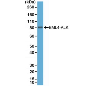 ALK Antibody EML4-ALK Fusion WB. Western blot analysis of H2228 non-small cell lung carcinoma cell lysate using recombinant rabbit monoclonal clone RM361 demonstrates a distinct band near 80 kDa corresponding to EML4-ALK variant 3 fusion protein expression. The observed signal supports selective detection of clinically relevant ALK fusion-associated oncogenic kinase protein involved in lung adenocarcinoma-associated receptor tyrosine kinase signaling and precision oncology biomarker pathways.