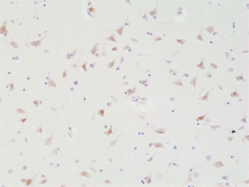 SATB2 Antibody Brain Immunohistochemistry. IHC staining of FFPE human brain tissue with recombinant SATB2 antibody at 1:200.