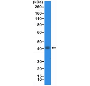 NKX2.1 Antibody for WB. Western blot analysis of human TT cell lysate. Lane 1: human TT cell lysate. The recombinant rabbit monoclonal clone RM373 antibody detects a band at approximately 38-45 kDa, consistent with the predicted molecular weight of Thyroid transcription factor 1 (NKX2-1). NKX2-1 is a nuclear homeobox transcription factor expressed in epithelial cells of lung and thyroid lineage, and detection of this band in TT cell lysate reflects expression of the transcription factor in thyroid-derived cells. Antibody dilution: 1:20,000.