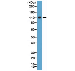 MSH2 Antibody for Western Blot (clone RM375) / MSH2 Western Blot Antibody. Western blot analysis of human HeLa cell lysate using MSH2 Antibody for Western Blot (clone RM375) at 1:1000 dilution. A band is detected at approximately 105 kDa, consistent with the predicted molecular weight of MutS homolog 2 / MSH2.