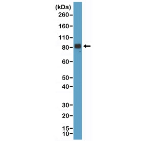 Chromogranin A Antibody for WB Brain WB. Western blot analysis of Chromogranin A / CHGA expression in human brain tissue lysate using Chromogranin A Antibody for WB, clone RM385 at 1:1000. A band is detected at approximately 70-90 kDa, consistent with glycosylated forms of CHGA and aligning with the predicted molecular weight of 51 kDa with post-translational modification-dependent migration.