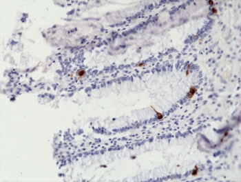 Chromogranin A Antibody Colon IHC. Immunohistochemistry staining of FFPE human colon tissue with recombinant Chromogranin A antibody at 1:10,000.