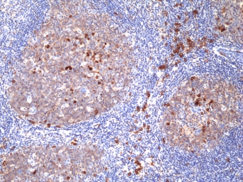 IHC staining of FFPE human tonsil tissue with recombinant CD38 antibody at 1:100.