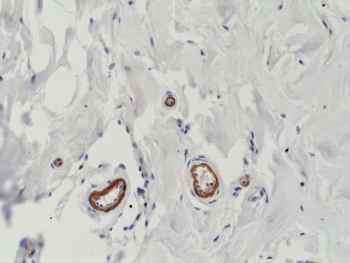 Recombinant VEGFA Antibody Human Breast IHC. Immunohistochemical staining of FFPE human breast tissue using Recombinant VEGFA Antibody (clone RM391) at 1:200 dilution. An HRP-conjugated secondary antibody with DAB substrate was used for detection. Recombinant VEGFA Antibody demonstrates VEGFA expression in vascular-associated structures within breast tissue, supporting studies of angiogenesis, endothelial signaling, vascular remodeling, and VEGF-mediated regulation of tissue homeostasis.
