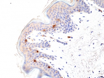CD1A Antibody for IHC. Immunohistochemistry analysis of CD1A / CD1a expression in FFPE human skin tissue using CD1A Antibody. Membranous and cytoplasmic staining is observed in scattered dendritic cells within the epidermis, consistent with Langerhans cell localization, while surrounding keratinocytes remain largely negative. The distribution of CD1a-positive cells along the epithelial layer highlights tissue-resident immune surveillance at the skin barrier and supports evaluation of antigen-presenting cell presence in epithelial tissues.