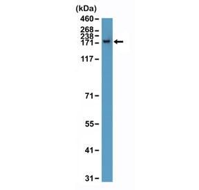 CPS1 Antibody T-cell WB. Western blot analysis of Carbamoyl Phosphate Synthetase 1 / CPS1 in human T-cell lysate using recombinant rabbit monoclonal CPS1 antibody, clone RM395. A band is detected at approximately 165 kDa, consistent with the predicted molecular weight of CPS1, demonstrating antibody detection of CPS1 under non-classical lysate conditions and supporting cross-context validation of target recognition.