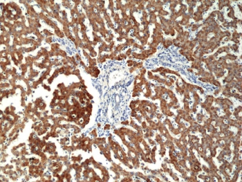 CPS1 Antibody Liver IHC. Immunohistochemistry of Carbamoyl Phosphate Synthetase 1 / CPS1 in FFPE human liver tissue using recombinant rabbit monoclonal CPS1 antibody, clone RM395. Strong HRP-DAB brown cytoplasmic staining highlights hepatocytes, consistent with mitochondrial localization of this urea cycle enzyme and supporting its use as a hepatocyte-associated marker, while surrounding non-parenchymal cells remain largely negative and nuclei are counterstained blue. Heat induced epitope retrieval was performed by boiling tissue sections in pH 9 10 mM Tris with 1 mM EDTA for 20 min followed by cooling prior to staining.
