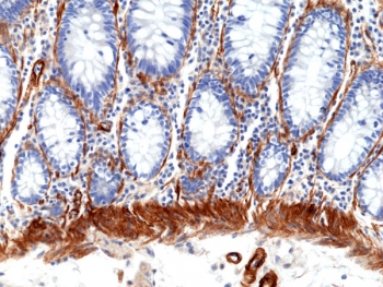 Caldesmon Antibody / CALD1 Cell Adhesion and Structural Connectivity Protein Antibody. Immunohistochemistry analysis of Caldesmon (CALD1) in human colon tissue. FFPE human colon stained with Caldesmon Antibody at 1:100 demonstrates strong HRP-DAB brown cytoplasmic staining in smooth muscle cells of the muscularis layer and along the base of the mucosa. The staining highlights elongated, organized cell layers with dense filament-associated cytoplasmic signal consistent with cytoskeletal linkage at sites of structural connectivity and tissue anchoring. Epithelial cells lining the crypts show minimal staining, supporting localization of CALD1 to cytoskeletal networks that contribute to adhesion-associated structural integrity.
