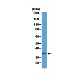 CD8A Antibody for WB - Human T-cell lysate. Western blot analysis of CD8 alpha (CD8A) in human T-cell lysate shows a band at approximately 26-40 kDa, consistent with the predicted molecular weight and glycosylation-dependent migration of this membrane glycoprotein. The signal reflects endogenous CD8A expression in cytotoxic T lymphocytes, supporting use in western blot analysis of human immune cell samples (clone RM397).