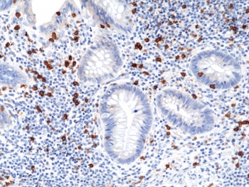IHC staining of FFPE human appendix tissue with recombinant CD8a antibody at 1:100.