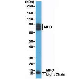 Myeloperoxidase Antibody for WB / MPO Western Blot Antibody (clone RM407). Western blot analysis of human HL60 cell lysate using recombinant Myeloperoxidase antibody for WB (clone RM407) at 1:200 dilution. Bands are detected at approximately 13 kDa and ~70-75 kDa, consistent with the light (beta) chain and the heavy (alpha) chain associated form of Myeloperoxidase / MPO. Additional higher molecular weight signal near ~150 kDa may represent the mature glycosylated MPO enzyme complex. The presence of multiple bands reflects the known proteolytic processing and glycosylation of MPO during granulocyte maturation.
