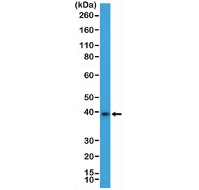 Western blot testing of mouse brain tissue lysate with recombinant MSI2 antibody at 1:2000 dilution. Predicted molecular weight ~35 kDa.