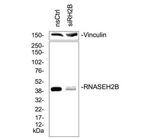 Western blot testing of lysate from human Hela cells treated with RNAseH2B siRNA/RNAiMaxx for 72 hours. Courtesy of Dr. Antje Neeb, The Institute of Cancer Research, London, UK