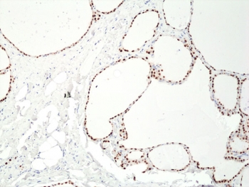 PAX8 Antibody / Epithelial Lineage Transcription Factor Antibody immunohistochemistry in human thyroid tissue showing strong nuclear HRP-DAB brown staining in follicular epithelial cells. Paired box protein Pax-8 (PAX8) expression is localized to nuclei lining well-defined thyroid follicles, with clear staining of epithelial cells surrounding colloid-filled lumina and minimal signal in stromal or interstitial compartments. The nuclear staining pattern highlights transcriptionally active epithelial cells and supports the role of PAX8 as a lineage-defining transcription factor regulating epithelial identity. Negative cells retain hematoxylin-only nuclear staining, providing clear contrast for interpretation within preserved tissue architecture.
