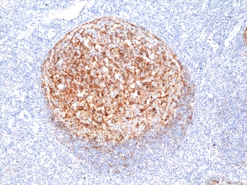 Clusterin Antibody Human Tonsil IHC. Immunohistochemistry analysis of FFPE human tonsil tissue using Clusterin antibody for WB. The recombinant rabbit monoclonal antibody clone RM437 demonstrates strong cytoplasmic and extracellular staining within lymphoid follicles, consistent with Clusterin / CLU expression as a secreted glycoprotein. Signal is enriched in follicular regions and surrounding microenvironment, reflecting accumulation of this processed and secreted protein, while background staining remains low. HIER: boil tissue sections in 10 mM Tris with 1 mM EDTA, pH 9, for 20 min followed by cooling prior to staining.