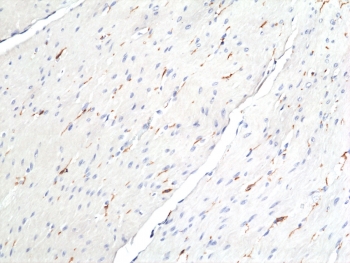 IHC staining of FFPE human colon tissue with recombinant DOG1 antibody at 1:100. DOG1-positive cells are interstitial cells of Cajal (ICCs) located within the muscle layer.