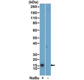 H2BK5ac Antibody / HIST1H2B Early Chromatin Activation Antibody (clone RM455) for WB. Western blot analysis of HIST1H2B / Histone H2B Lys5 acetylation (H2BK5ac) in acid extracts of human HeLa cells untreated (-) or treated (+) with sodium butyrate using H2BK5ac Antibody / HIST1H2B Early Chromatin Activation Antibody. A band is detected at the predicted molecular weight corresponding to acetylated Histone H2B, with increased signal in treated cells consistent with enhanced histone acetylation and early chromatin activation following HDAC inhibition.