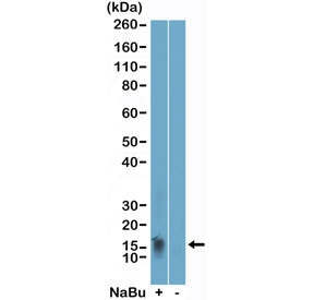 H2BK11ac Antibody / HIST1H2B Transcription Regulation Antibody (clone RM456) for WB. Western blot analysis of HIST1H2B / Histone H2B Lys11 acetylation (H2BK11ac) in acid extracts of human HeLa cells untreated (-) or treated (+) with sodium butyrate using H2BK11ac Antibody / HIST1H2B Transcription Regulation Antibody. A band is detected at the predicted molecular weight corresponding to acetylated Histone H2B, with increased signal in treated cells consistent with enhanced histone acetylation and transcription-associated chromatin regulation following HDAC inhibition.