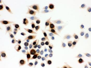 ICC testing of human SMMC-7721 cells with Cyclin A antibody.
