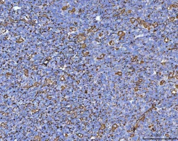 Vimentin Antibody Clone V9 Tonsil IHC. Immunohistochemistry staining of FFPE human tonsil tissue with Vimentin Antibody Clone V9. HIER: boil tissue sections in pH8 EDTA for 20 min and allow to cool before testing.