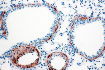 IHC staining of FFPE rat lung tissue with ACTA2 antibody. HIER: boil tissue sections in pH8 EDTA for 20 min and allow to cool before testing.